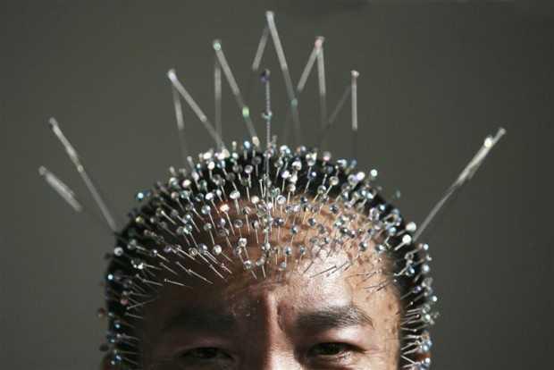 7 Ways Acupuncture Affects Your Brain | San Francisco Chiropractic ...