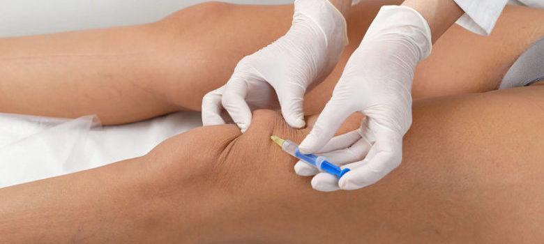 prolotherapy alternative medicine