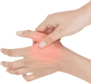 Chiropractic Care for Neuropathy in San Francisco