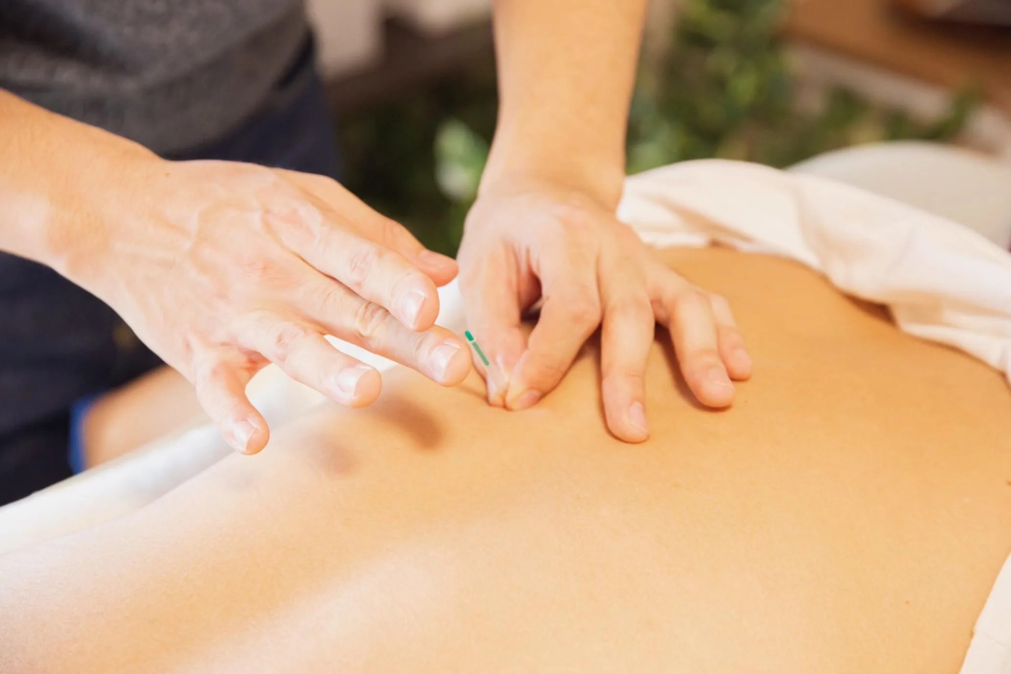 dry-needling-vs-acupuncture-