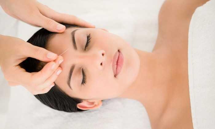 Facial Rejuvenation Acupuncture Benefits