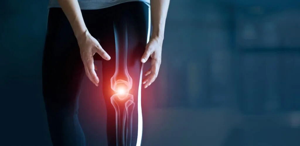 Osteoarthritis of the knee