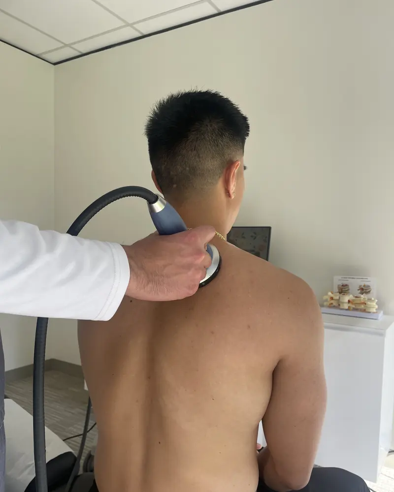 Shockwave therapy for a shoulder trigger point at Truspine San Francisco